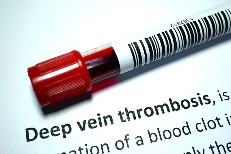 Deep Vein Thrombosis (DVT)