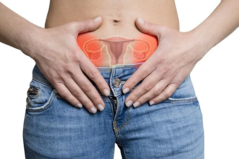Ovarian Vein Syndrome