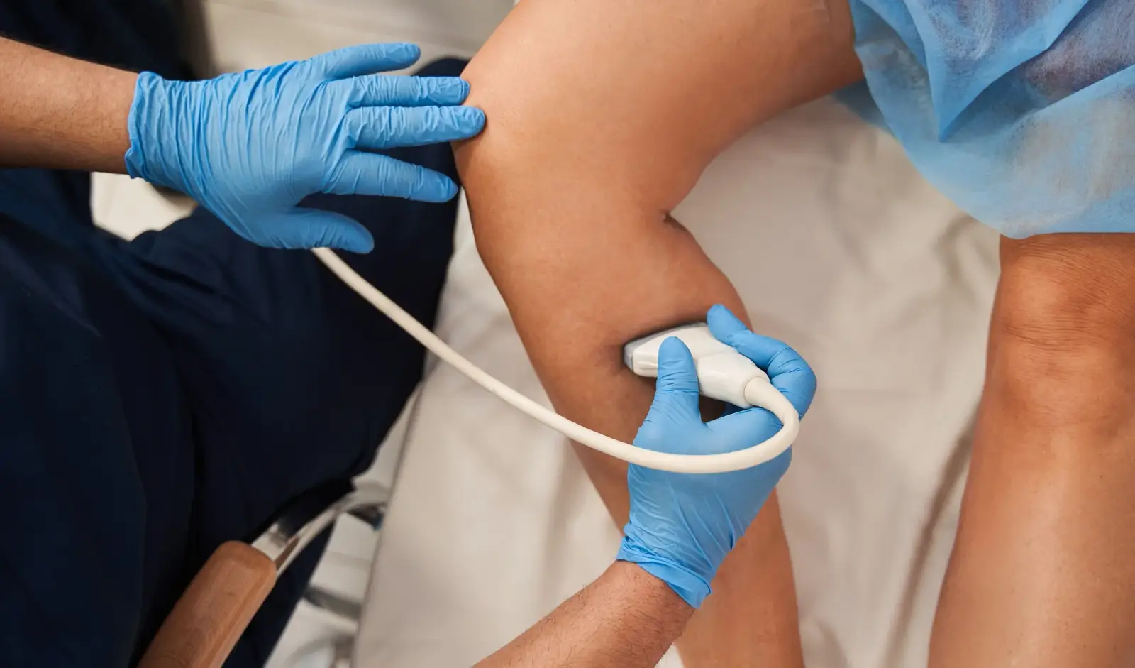 Vascular Access Image